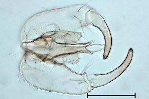 Hyperdiplosis #b